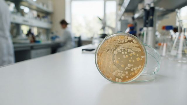Health & Body - Bifidobacterium animalis: probiotic bacteria supporting mammalian intestinal health