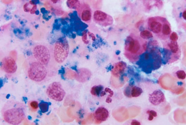 Health & Body - Bone marrow: cellular nurseries driving life-saving transplants